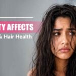 humidity skin effects, humid weather hair fall, oily scalp remedies, dry skin causes, Dermapuritys clinic, seasonal acne solutions, scalp health tips